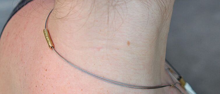 Papules on the neck