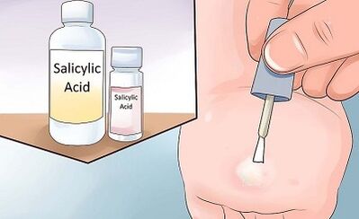 How to eliminate the folk ways of papillomas