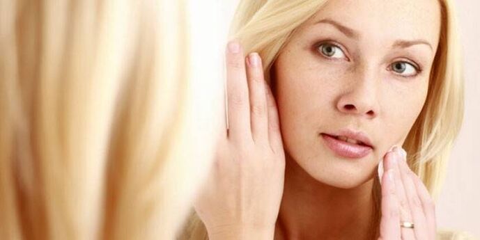 manifestation of human papillomavirus on the face