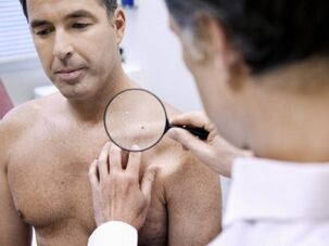 Diagnosis of papillomas in men